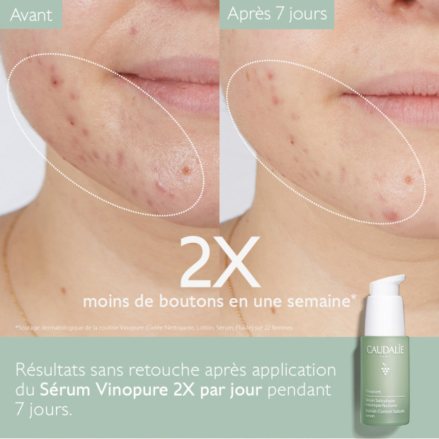 Caudalie VINOPURE Sérum Anti-Imperfections, 30ml | Parashop.com