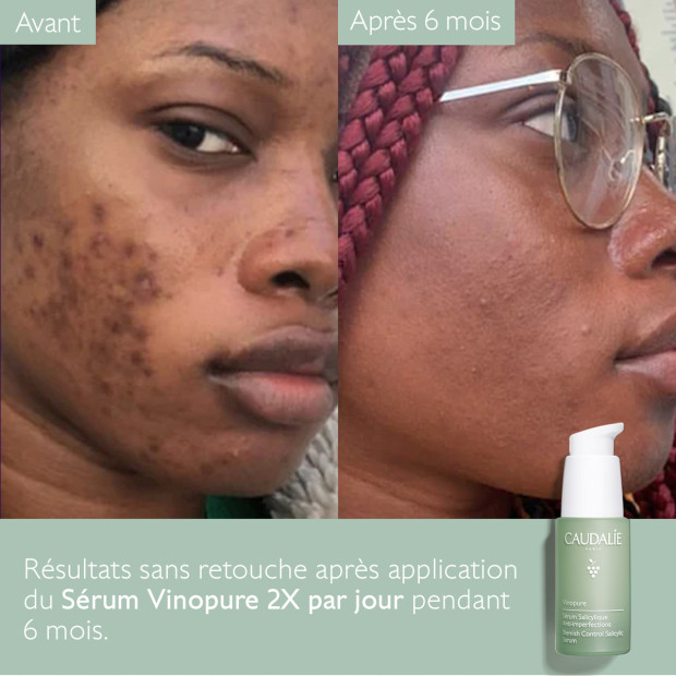Caudalie VINOPURE Sérum Anti-Imperfections, 30ml | Parashop.com