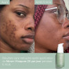 Caudalie VINOPURE Sérum Anti-Imperfections, 30ml | Parashop.com