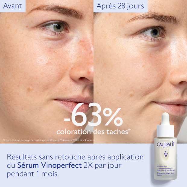 Caudalie VINOPERFECT Sérum Éclat Anti-taches, 30ml | Parashop.com
