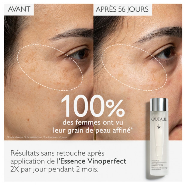 Vinoperfect Essence Glycolique Concentrée d'Éclat, 100ml
