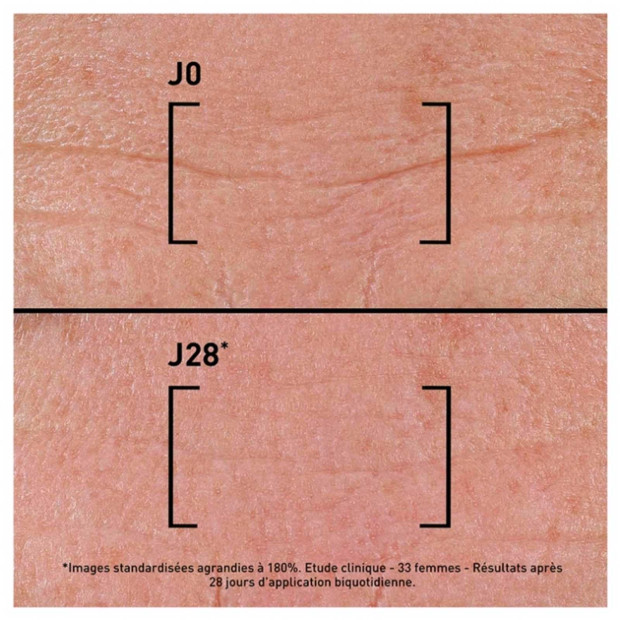 TIME-FILLER INTENSIVE 5XP Sérum Correction Tous Types de Rides, 30ml