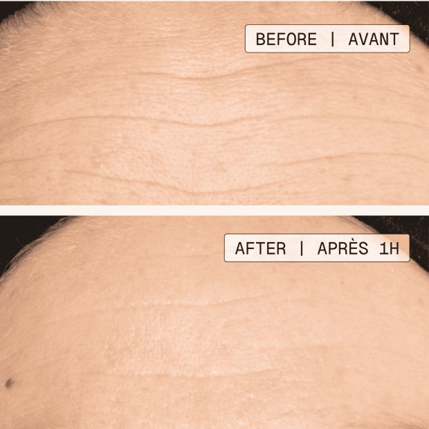 ULTIME EXPRESSION + Concentré rides profondes, 15ml