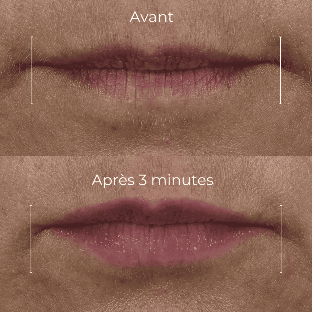 Derm Correxion Volumateur Lèvres, 10ml
