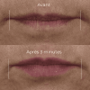 Derm Correxion Volumateur Lèvres, 10ml