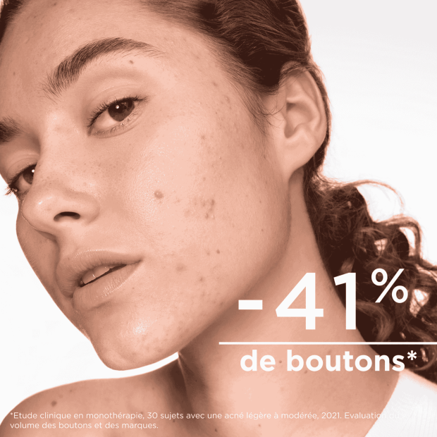 Sebium Kerato+ Gel-Crème Anti-Imperfections, 30ml