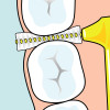 Brossette Interdentaire Angle™ Jaune 0.7mm, x6 Tepe - Parashop