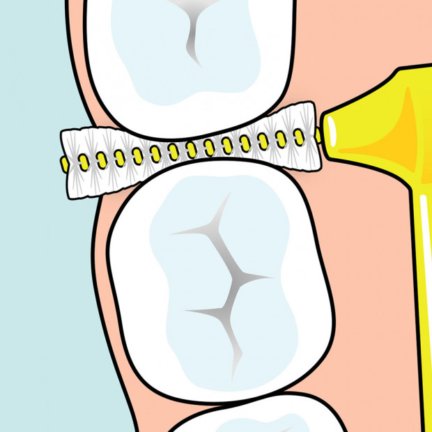 Brossette Interdentaire Angle™ Rouge 0.5mm, x6 Tepe - Parashop